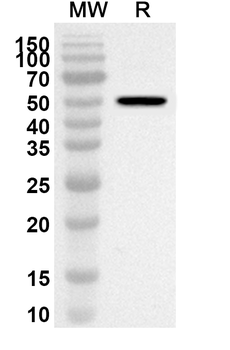ADSS2 Rabbit Polyclonal Antibody