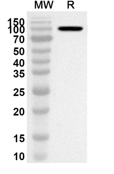 PADI4 Rabbit Polyclonal Antibody