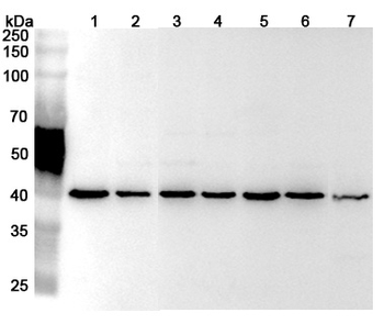 RPSA Rabbit Polyclonal Antibody
