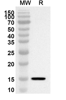 CEP43 Rabbit Polyclonal Antibody