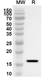 SPAG5 Rabbit Polyclonal Antibody