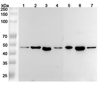 RSAD2 Rabbit Polyclonal Antibody
