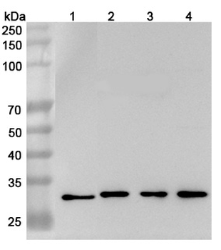 GSTO1 Rabbit Polyclonal Antibody
