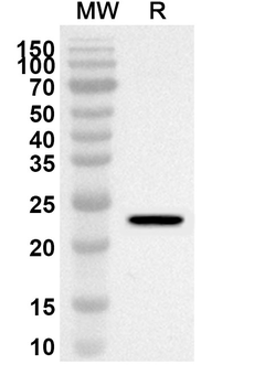 TRIM27 Rabbit Polyclonal Antibody