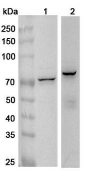 IGF2BP1 Rabbit Polyclonal Antibody
