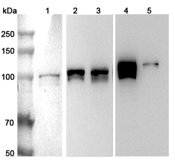 RBM15 Rabbit Polyclonal Antibody