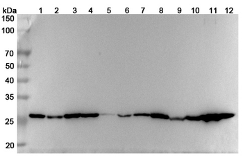 TPI1 Rabbit Polyclonal Antibody