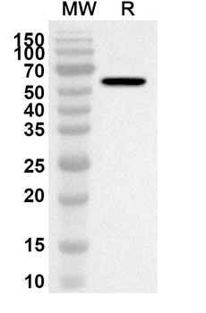 Porphyromonas gingivalis rgpB/Gingipain R2 Rabbit Polyclonal Antibody