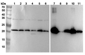 UQCRFS1 Rabbit Polyclonal Antibody