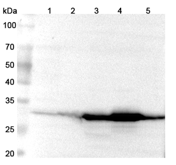 SULT1E1 Rabbit Polyclonal Antibody