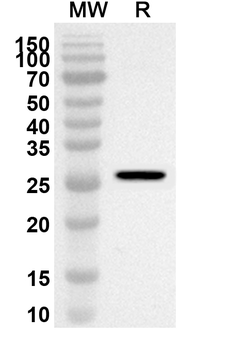 SKAP2 Rabbit Polyclonal Antibody