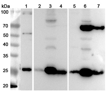 SDHB Rabbit Polyclonal Antibody