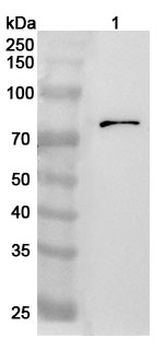 GFPT1 Rabbit Polyclonal Antibody