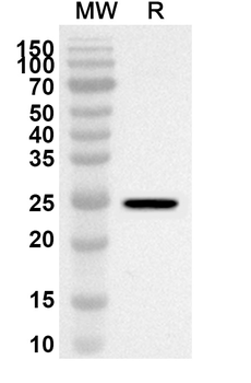 TRIM63 Rabbit Polyclonal Antibody