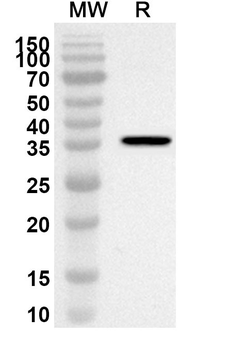 PDCD4/PD4 Rabbit Polyclonal Antibody