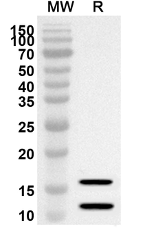 S100A8 & S100A9 Rabbit Polyclonal Antibody