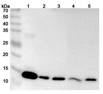 Gal-1/LGALS1 Rabbit Polyclonal Antibody