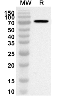 PSMD6 Rabbit Polyclonal Antibody
