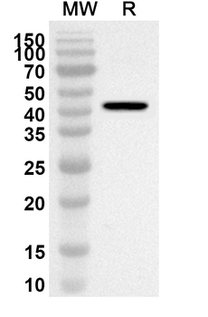 GOT2 Rabbit Polyclonal Antibody