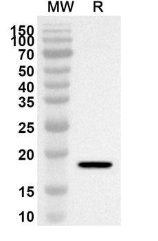 NUMBL Rabbit Polyclonal Antibody