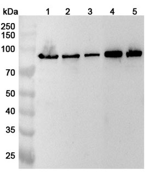 TRPV5 Rabbit Polyclonal Antibody