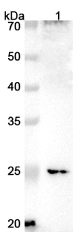 CLTRN Rabbit Polyclonal Antibody