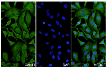 CANT1 Rabbit Polyclonal Antibody