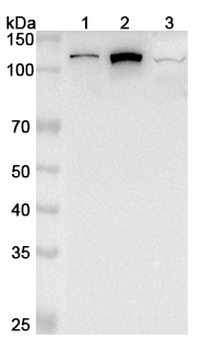 PITRM1 Rabbit Polyclonal Antibody