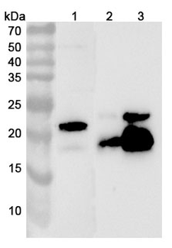 TAGLN Rabbit Polyclonal Antibody