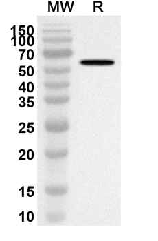 ANXA11 Rabbit Polyclonal Antibody
