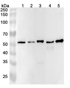 ANXA11 Rabbit Polyclonal Antibody