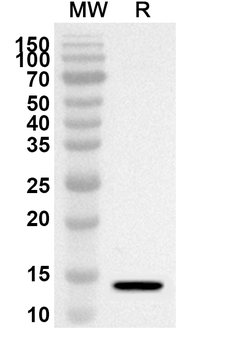 COMP Rabbit Polyclonal Antibody