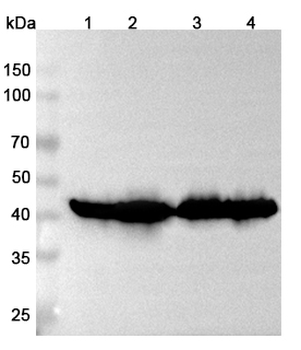 ACAA2 Rabbit Polyclonal Antibody