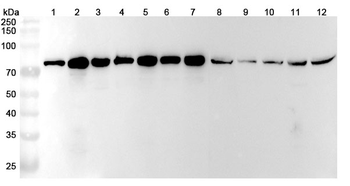 GARS1 Rabbit Polyclonal Antibody
