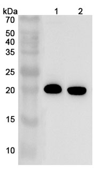TAGLN2 Rabbit Polyclonal Antibody