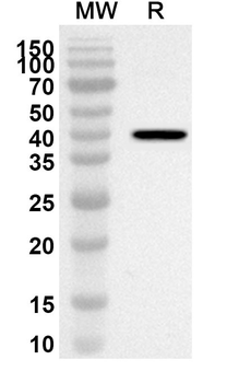 AXL/UFO Rabbit Polyclonal Antibody