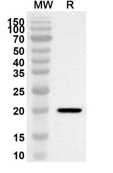 CCND1 Rabbit Polyclonal Antibody