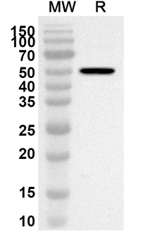 AHCY Rabbit Polyclonal Antibody
