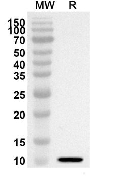 CXCL2/GRO-beta/MIP2-alpha Rabbit Polyclonal Antibody