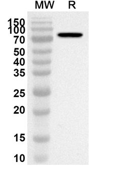 CD106/VCAM1 Rabbit Polyclonal Antibody