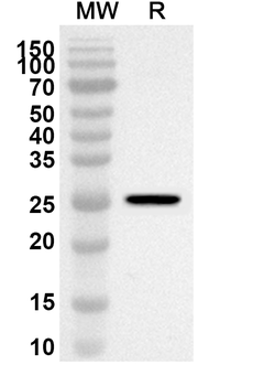 KRT15 Rabbit Polyclonal Antibody