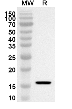 ATP5PF Rabbit Polyclonal Antibody