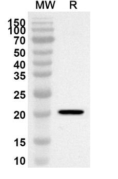 MYL6B Rabbit Polyclonal Antibody