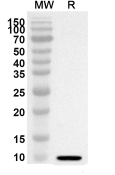 RBP1 Rabbit Polyclonal Antibody