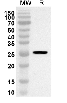 GSTA2 Rabbit Polyclonal Antibody