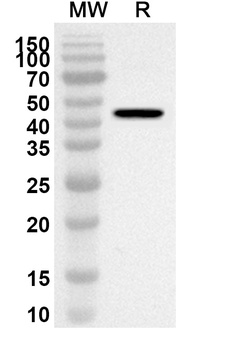 C8B Rabbit Polyclonal Antibody