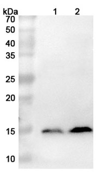 S100A9 Rabbit Polyclonal Antibody
