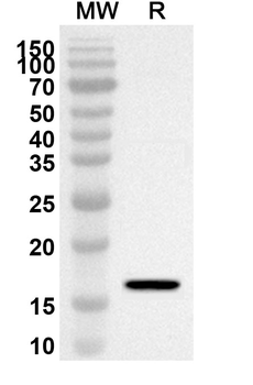 FABP3 Rabbit Polyclonal Antibody