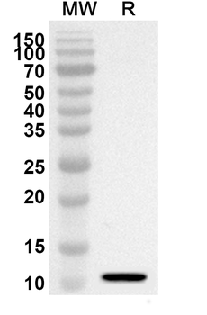 S100B Rabbit Polyclonal Antibody