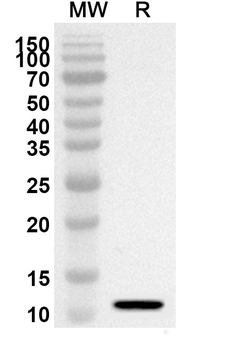 CXCL10/IP-10 Rabbit Polyclonal Antibody